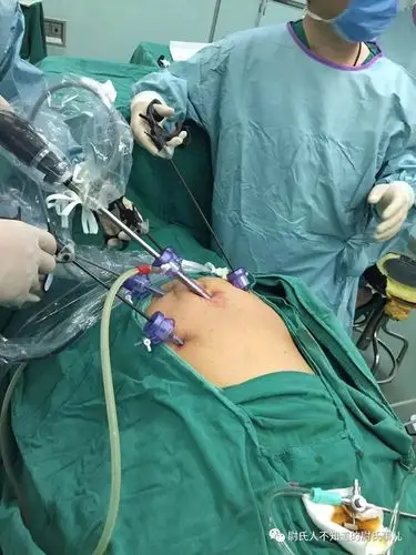 大手术,小切口,三院外一腹腔镜外科手术太神奇啦!