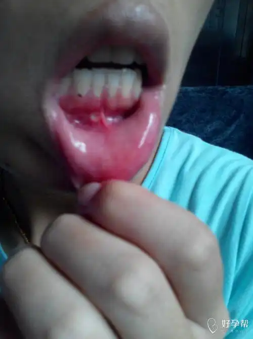 上火了上火了上火了啊!