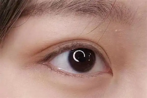 葡萄眼是什么眼型