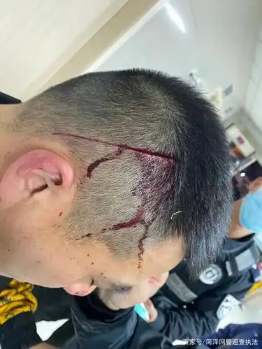 特警头部被砍两刀