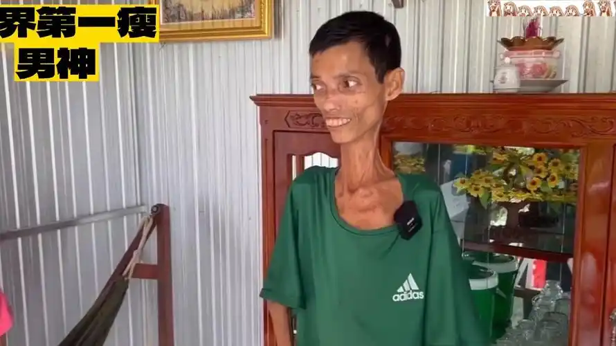 世界第一瘦男人,老婆却非常漂亮