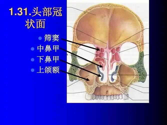 头部冠 1.31.头部冠 状面 筛窦 中鼻甲 下鼻甲 上颌额