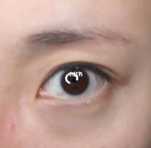 倒睫上睫毛眼尾位置倒睫求拯救