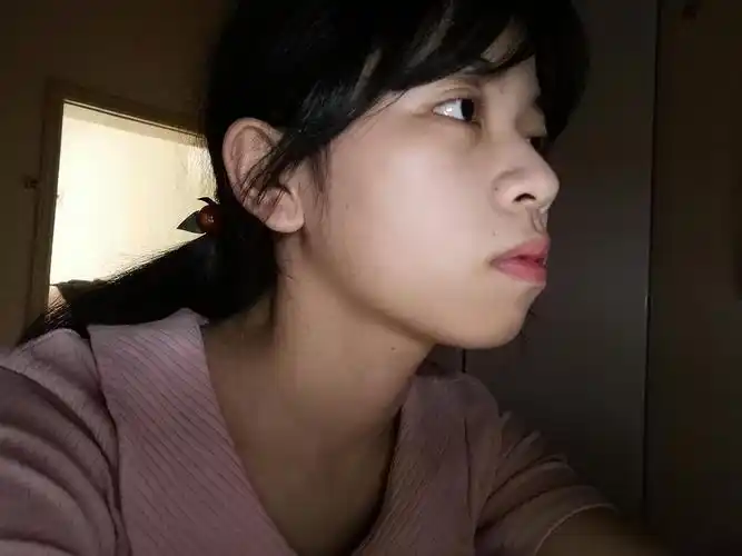 需不需要矫正啊?侧脸丑绝人寰