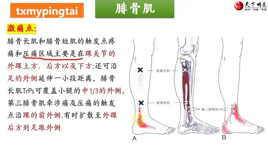 【腓骨肌】3d解剖——踝关节无力,外侧痛!