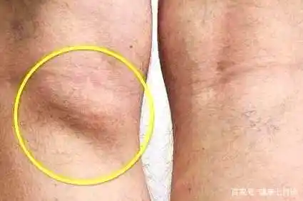 身体有病,淋巴结先知!这6处淋巴结决定了你90%的疾病,保护好它