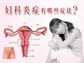 华都妇科医院:治疗盆腔炎的方法