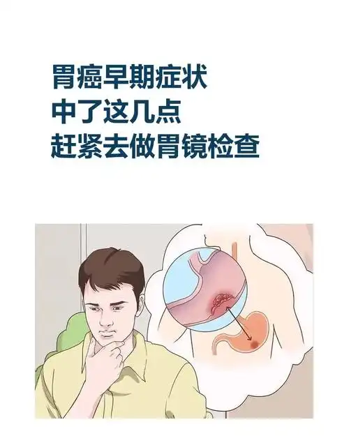 胃癌早期症状,中了这几点,赶紧去做胃镜检查