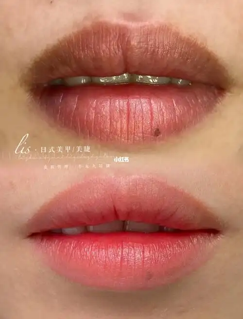 欧洲雾唇改乌唇前后对比