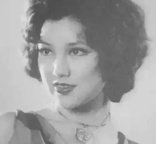 整容的后遗症有多可怕,不妨看看曾经的香港女神黄夏蕙.