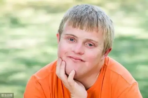 花7.6万做试管婴儿,却生了个唐氏宝宝,只因拒绝做这项检查