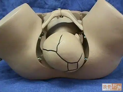 胎位图(附图片)——妈妈提前看