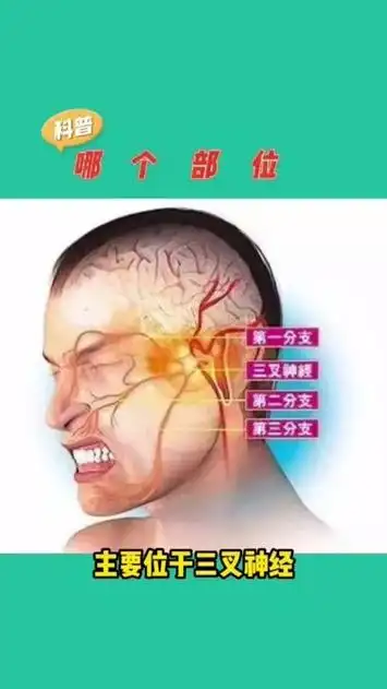 天下第一痛:三叉神经痛的疼痛部位在哪里