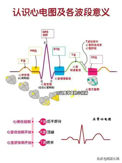 终于有人把心电图怎么看懂讲清楚了 676767