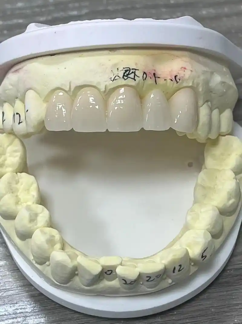 今日份分享959595 德国威兰德氧化锆9499949994 - 抖