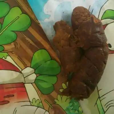 宝宝大便最近呈褐色,请问怎麼办?