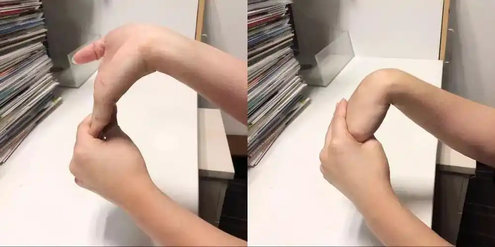 运动中腕关节受伤的处理攻略,超全!