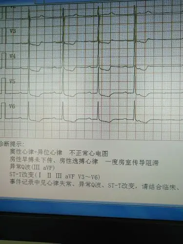记山西省人民医院心血管外科成功为1例80岁女性患者成功实施心脏不停