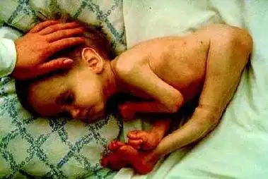 切尔诺贝利爆发大火:9.