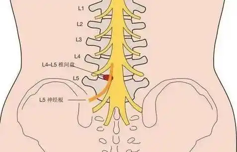骶骨疼痛的原因有哪些