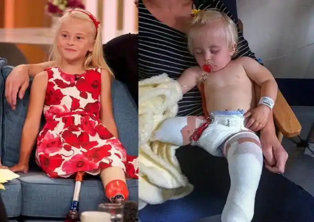 英国9岁截肢女孩成模特装两条义肢走t台自信十足