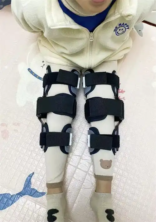 儿童xo型腿矫正器纠正膝内外翻小腿外翻绑腿带罗圈腿支具 o型腿/膝