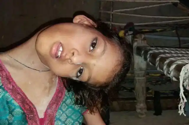 9岁小女孩患罕见怪病,脖子弯曲成90度,最大心愿走进校园上课