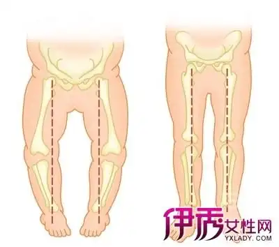 【图】婴儿小腿弯曲的正常图 妈妈们知道吗