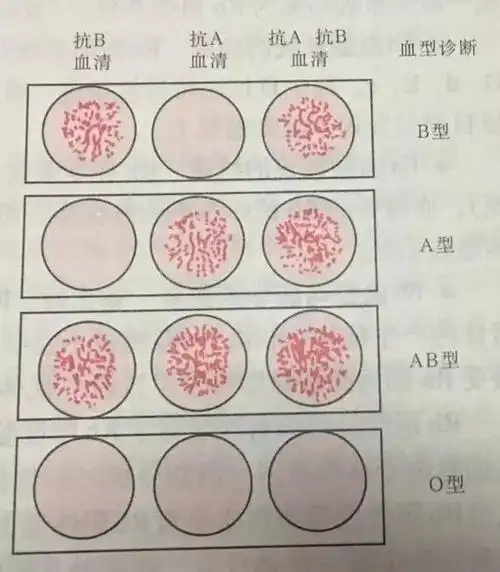 a型,b型,ab型…人为什么有不同的血型呢?
