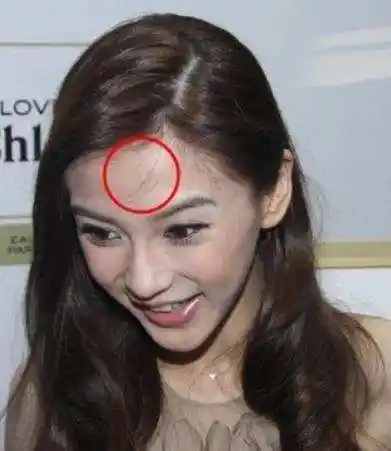 张馨予杨幂额头长同款痘称开天眼最后一位真让人不敢相信