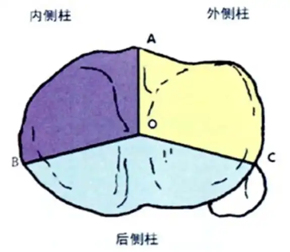 六,四柱分型该理论是在胫骨平台骨折的三柱分型理论基础上发展而来