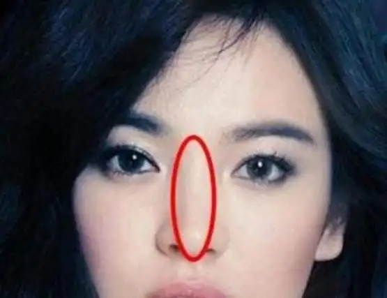 狮子鼻女人面相婚姻