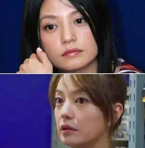 赵薇式嘴角下垂有没有?