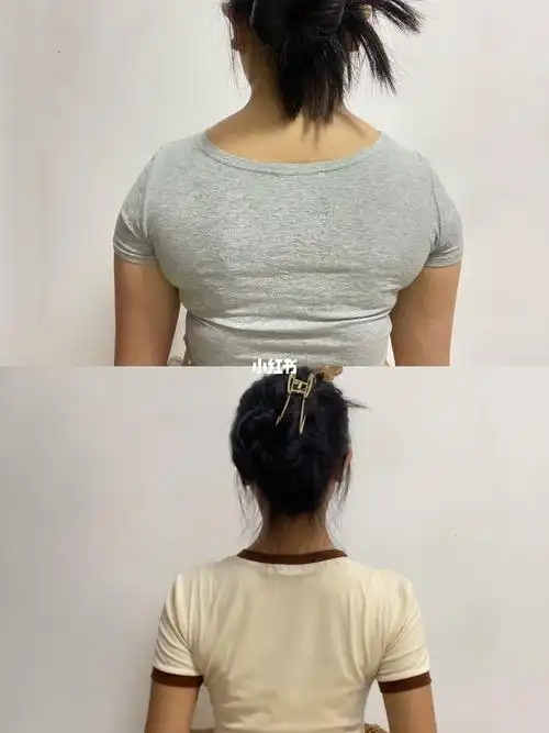 拥有直角肩对斜方肌说88