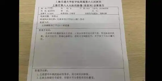 老阿姨骑车晚归遇大坑摔成骨折打8根钢钉