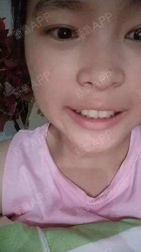 初一的时候吧,看得出门牙虎牙外突,当时真不觉得丑什_圈子-新氧美容