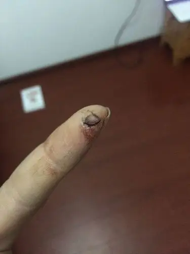  我来答 分享 微信扫一扫 网络繁忙 请稍后重试 新浪微博 qq空间