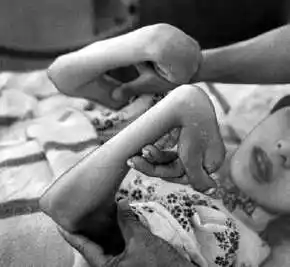 rare and weird diseases