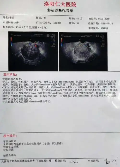 宫腔镜后第一天复查阴超