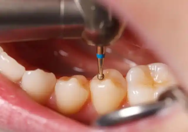 想长寿勤刷牙,平时刷牙做好5个方面的护理,保持口腔健康很重要