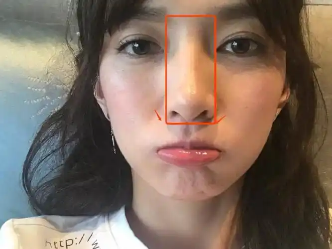 惊:江疏影居然整过鼻子!