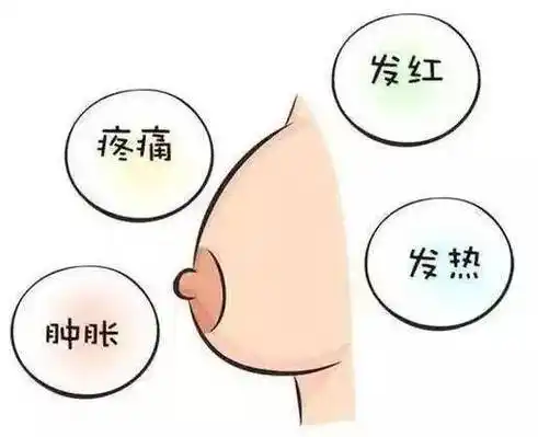 【妇产科普】新手妈妈患乳腺炎可以吃药边喂奶吗?