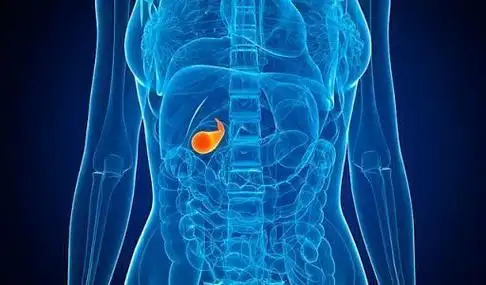 哪些原因会导致胆结石?医生提醒:避开6个因素,胆囊才安全