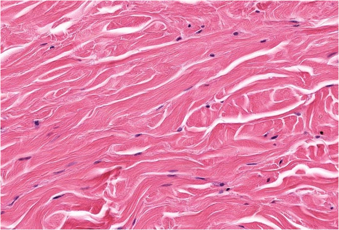 屏幕显示为何组织[图]a,疏松结缔组织b,规则致密结缔组.