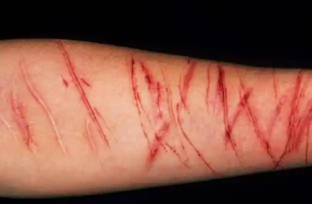 因暴食而进行的自残行为_手机搜狐网