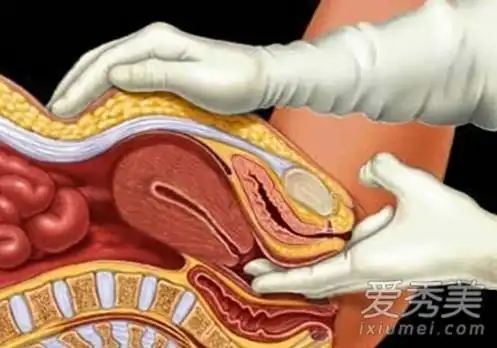 女性检查女性阴道全套检查全过程揭晓图