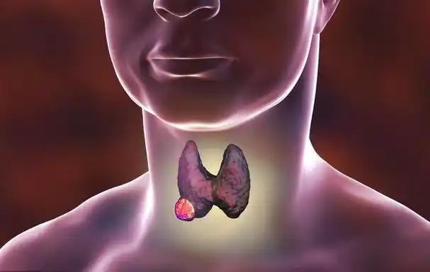 甲状腺不好不能吃黄豆吗?医生:不想病症恶化,这些食物要少碰