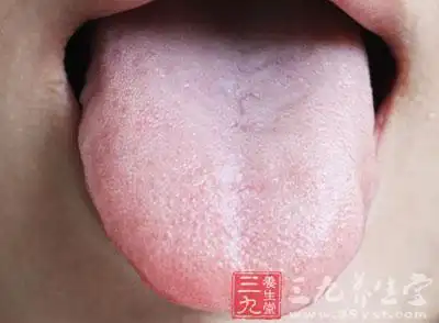 舌癌虽不像肺癌,胃癌那么为大家熟知
