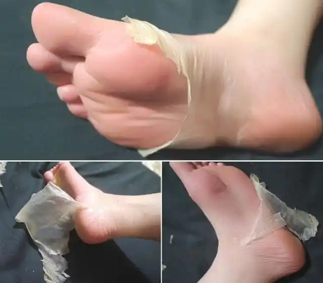 才看到自己的脚粗糙起皮毫无美感,快来试试它,撕掉的瞬间爽炸了