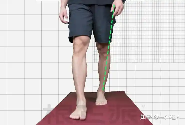 一,小腿骨变弯的必然性